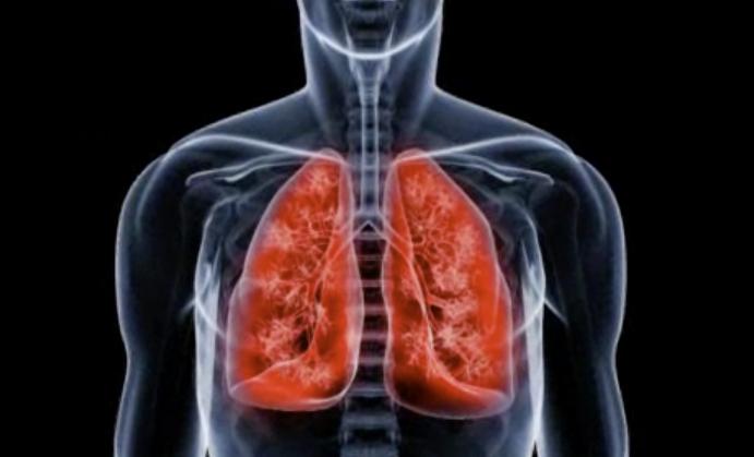 NSF flu respiratory illness