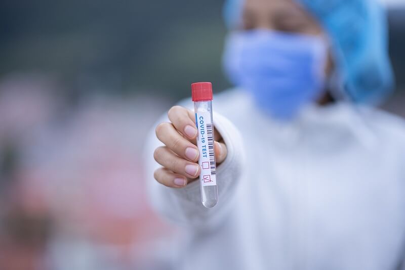woman health professional holding test tube